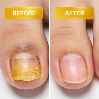 Glowtone Fungal Nail Renewal Patches