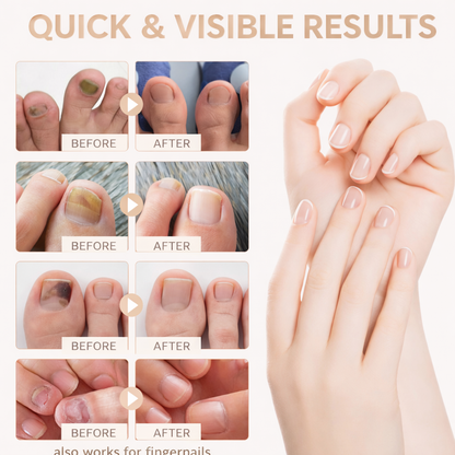 Glowtone Fungal Nail Renewal Patches