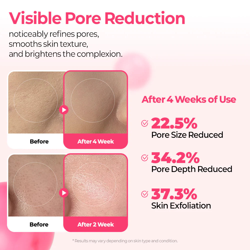 Glowtone Cyano Pink Spicule Serum – Advanced B12 Firming & Regenerating Serum