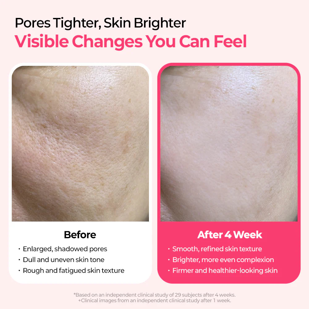 Glowtone Cyano Pink Spicule Serum – Advanced B12 Firming & Regenerating Serum