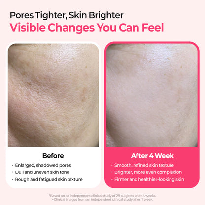 Glowtone Cyano Pink Spicule Serum – Advanced B12 Firming & Regenerating Serum