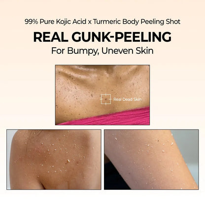 Glowtone Brightening Peel Shot – Kojic Acid & Turmeric Body Spray